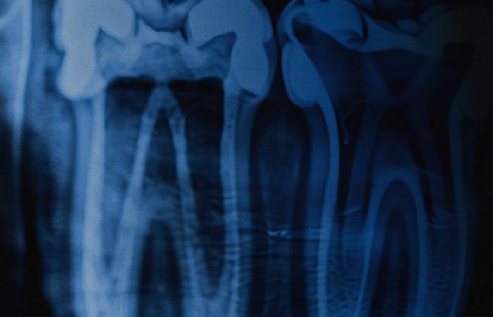 Повернення гідності: чому стоматологія стала критичним етапом реабілітації азовців